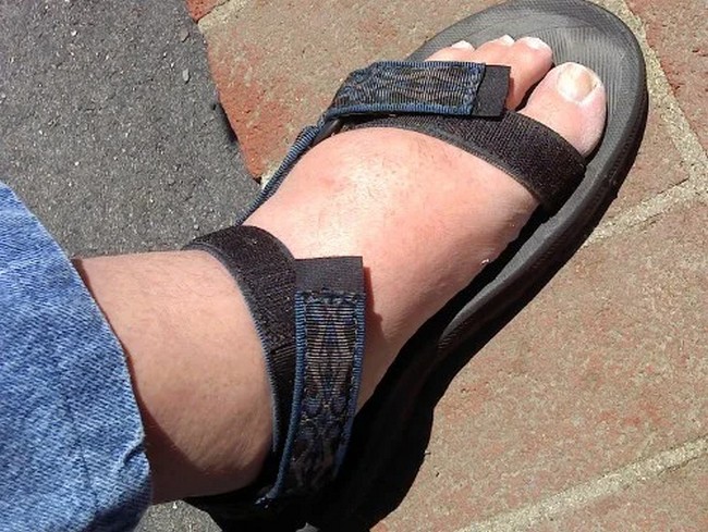 Fixing Velcro Sandals to Fit Wide Feet DIY